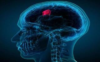 World Brain Tumour Day 2021: What is the impact of COVID-19 on brain tumour treatment? All your FAQs answered here