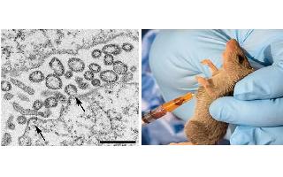 Jagran Explainer: Lassa fever sparks concerns in UK | What is it and what are its symptoms