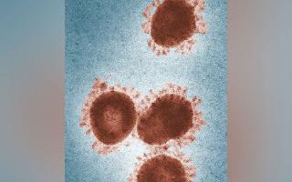 48,500-Year-Old ‘Zombie Virus’ Buried In Ice Revived By Scientists In Russia; What It Means