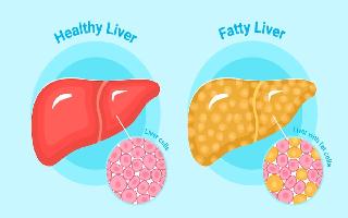 World Liver Day 2023: 5 Signs Of Fatty Liver On Your Face That You Must Not Ignore