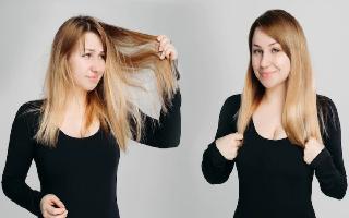 Hair Fall: 5 Essential Vitamins To Include In Your Daily Diet To Control Falling Hair