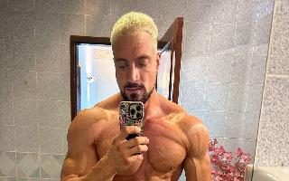 German Fitness Influencer Jo Lindner Passes Away At 30 Of Aneurysm; Know All About This Health Condition