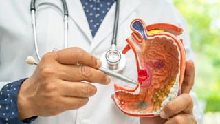 5 Early Signs And Symptoms Of Stomach Cancer That You Should Know About