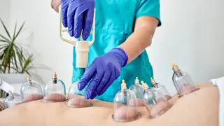 Cupping Therapy: 5 Potential Benefits For Arthritis, Hypertension And More