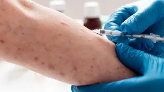 How Contagious Is Mpox Virus? Who Is At High Risk? Know Diagnosis And Treatment