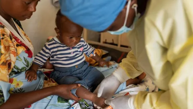 mpox-virus-who-not-new-covid-remark-monkeypox-symptoms-spread-global-cases-pheic-mpox-news