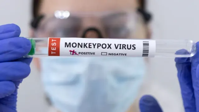 mpox-scare-central-drug-regulator-gives-nod-to-indias-home-grown-rt-pcr-kit