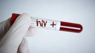 Uttarakhand News: 19 Men Test HIV Positive After 'Sexual Engagements' With Same Girl In Nainital