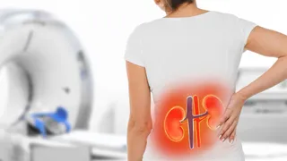 Dehydration And Kidney Stones: Why Winter Poses Hidden Risks To Kidney Health? Know From Expert