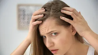 4 Effective Ways To Stop Receding Hairline Naturally