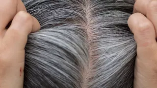 5 Simple Ways To Boost Melanin In Your Hair Naturally And Prevent Grey Hair