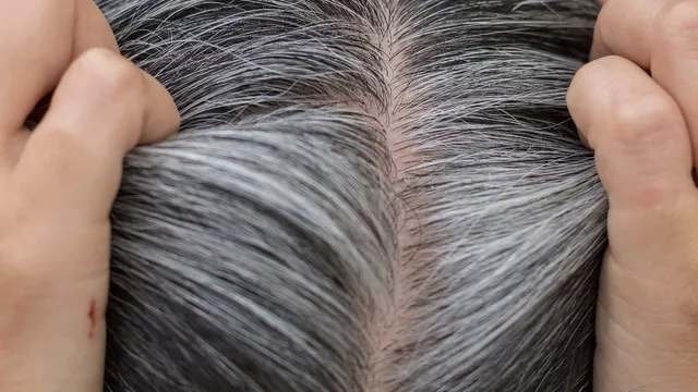 5-simple-ways-to-boost-melanin-in-your-hair-naturally-and-prevent-grey-hair