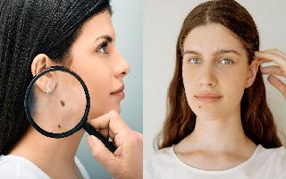 mole-astrology-moles-on-your-body-can-reveal-a-lot-about-your-personality-know-how