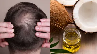 4 Natural Oils To Regrow Hair On Your Bald Patches
