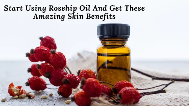 start-using-rosehip-oil-and-get-these-amazing-skin-benefits