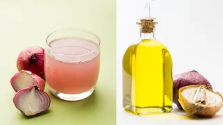Onion Juice vs Onion Oil: Which Is A Better Choice For Quick Hair Growth?
