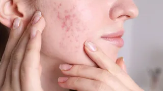 Postpartum Skincare And Haircare Guide: Dermatologist Shares Tips To Tackle Beauty Woes After Pregnancy