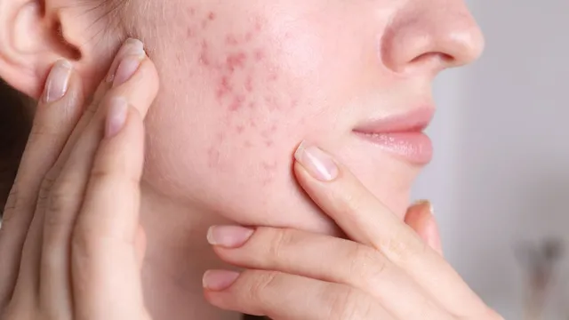 postpartum-skincare-and-haircare-guide-dermatologist-shares-tips-to-tackle-beauty-woes-after-pregnancy