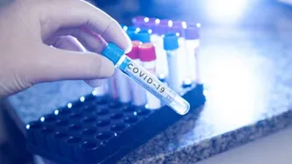 Delhi Issues Advisory To Hospitals After 23 Covid-19 Cases Detected In National Capital