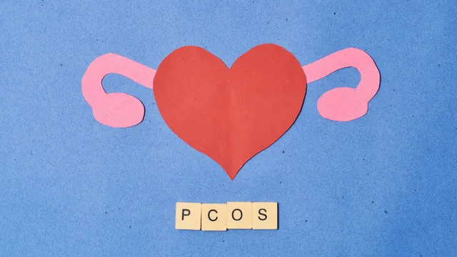 pcos-and-fertility-doctor-explains-what-women-need-to-know-before-its-too-late