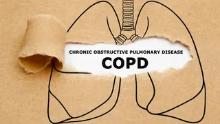 what-is-chronic-obstructive-pulmonary-disease-doctor-shares-strategies-to-control-flareups-and-exacerbations-caused-by-copd