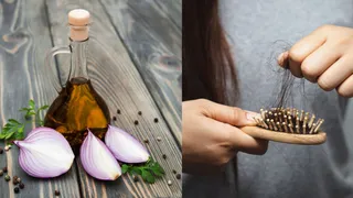 DIY Homemade Onion Hair Oil To Banish Hair Fall Naturally In 7 Days
