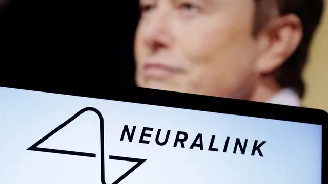 elon-musks-neuralink-helps-monkey-see-things-that-arent-really-there-aims-to-restore-human-vision