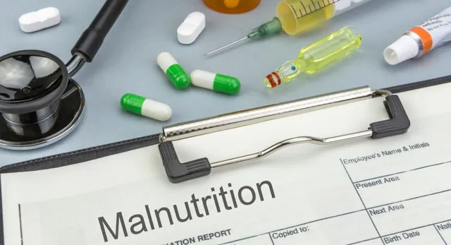 up-launches-sambhavah-50-campaign-to-combat-malnutrition-in-children-across-all-districts-details