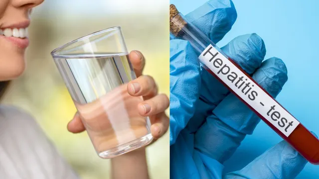 everyday-habits-that-can-protect-you-from-hepatitis-for-life-doctor-explains