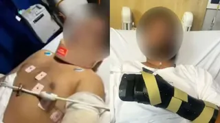 'My Hand Was Hanging By Thread': Indian-Origin Man Slashed, Stabbed By Teenagers; Recounts Horror Attack In Melbourne