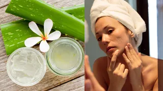 How To Fade Face Scars Naturally At Home? 5 Home Remedies To Try