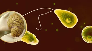 Brain-Eating Amoeba Detected In Queensland Water: Is Tap Water Still Safe?