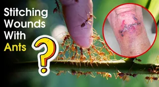 People Used Ants To Stitch Wounds; Know How And Why?
