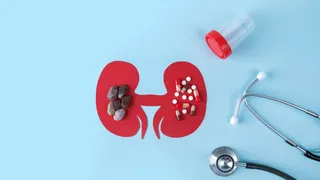 Kidney Stones On The Rise: Doctor Shares Lifestyle Changes That Can Lower Risk