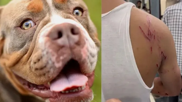 delhi-family-sets-pet-rottweiler-dog-loose-on-neighbours-after-scuffle-over-parking-in-welcome-5-bitten