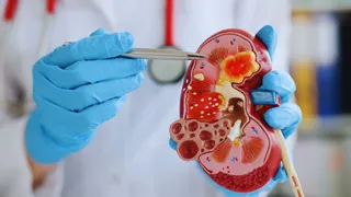 MP Health Scare: 7 Children Die Within A Month In Chhindwara Due To Suspected Kidney Infections; Authority Issue Advisory For 'Certain' Syrups