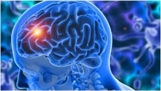 Delhi: Air Pollution Now A Major Cause Of Brain Strokes, Lancet Report Finds