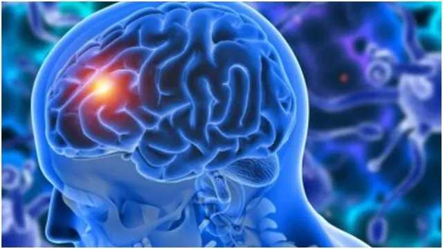 delhi-air-pollution-now-a-major-cause-of-brain-strokes-lancet-report-finds