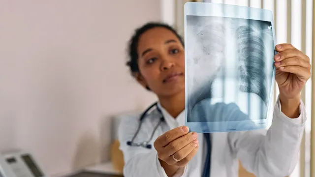 why-lung-cancer-kills-18-million-people-a-year-doctor-explains-how-early-detection-can-change-that