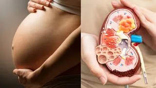 Pregnancy With Kidney Disease: Doctor Shares Risks, Care Tips And What Every Woman Should Know