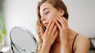 Why Skin Becomes Sensitive Every Winter; Dermatologist Explains Hidden Reason And Skincare Tips