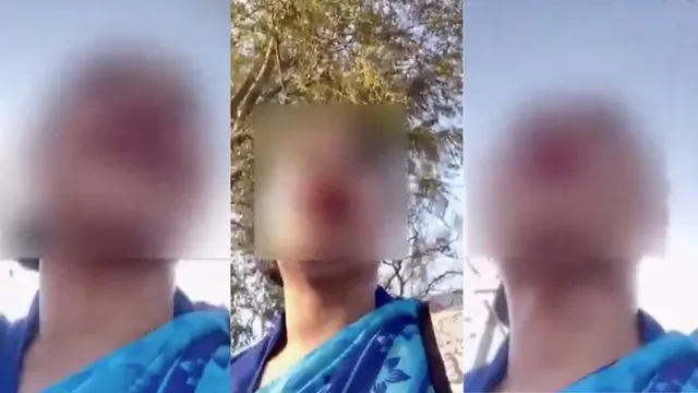 bengaluru-woman-alleges-harassment-by-naked-man-in-car-during-daylight-video-goes-viral