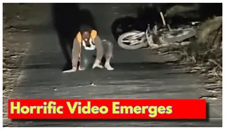 Gujarat Man Starts Crawling On Road, Barking After Being Bitten By Dog; What Doctor Said On His Animal-Like Behaviour | Video