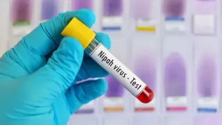 Japan Moves Closer To Nipah Protection With First Human Vaccine Trial In April