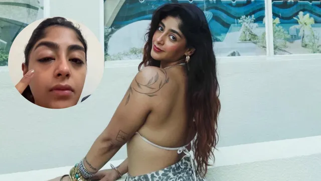 splitsvilla-16-contestant-preet-singh-alleges-assault-by-influencer-male-friend-eyes-swollen-face-bruised