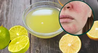 i-applied-lemon-to-my-sensitive-skin-results-made-me-regret-it