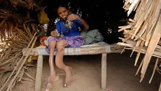 MP Water Crisis: 1,480 Villages Battle Fluorosis As Safe Water Schemes Fail; Children Worst Affected