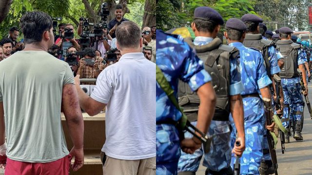 raf-to-probe-whether-pellet-guns-were-fired-on-protesters-during-cjps-parliament-march-rahul-brings-victim-to-fore