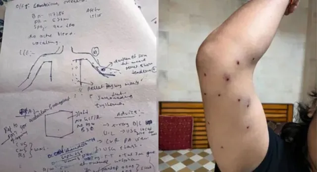pellet-gun-row-crpf-identifies-raf-jawan-who-fired-7-rounds-during-cjps-sansad-chalo-march-probe-underway