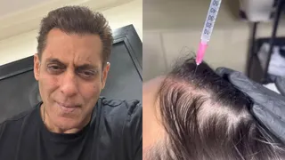 What Is PRP Hair Treatment? Everything To Know About Salman Khan's Viral Hair Therapy